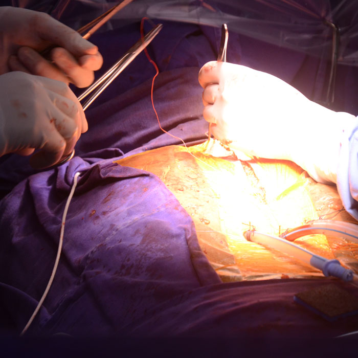 Intensive Care